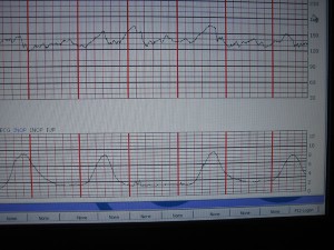 Contractions!